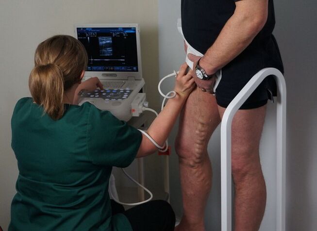 Εξέταση των φλεβών πριν την πήξη με laser για κιρσούς